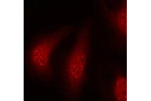 Immunofluorescence staining of methanol-fixed Hela cells using p90RSK(Phospho-Thr348) Antibody. (RPS6KA1 抗体  (pThr348))