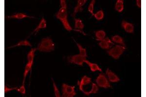 ABIN6274797 staining HepG2 by IF/ICC. (ACAT1 抗体  (Internal Region))