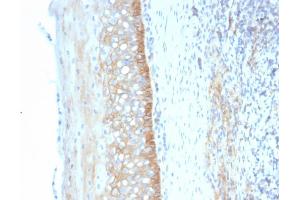 Immunohistochemistry (IHC) image for anti-5'-Nucleotidase, Ecto (CD73) (NT5E) antibody (ABIN6940229)