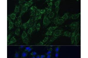 Immunofluorescence analysis of C6 cells using AEBP1 Polyclonal Antibody at dilution of 1:100 (40x lens). (AEBP1 抗体)