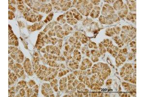 Image no. 1 for anti-Centromere Protein J (CENPJ) (AA 979-1089) antibody (ABIN599271) (CENPJ 抗体  (AA 979-1089))