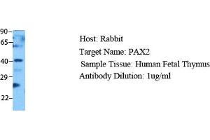 Host: Rabbit Target Name: PAX2 Sample Type: Human Fetal Thymus Antibody Dilution: 1. (PAX2A 抗体  (Middle Region))
