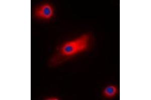 Immunofluorescent analysis of Cone Arrestin staining in HepG2 cells.
