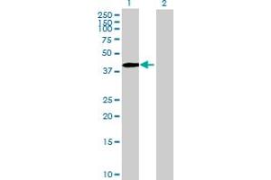 Western Blot analysis of ZNF485 expression in transfected 293T cell line by ZNF485 MaxPab polyclonal antibody. (ZNF485 抗体  (AA 1-402))