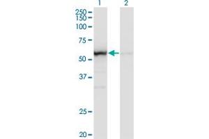 Western Blot analysis of OXSR1 expression in transfected 293T cell line by OXSR1 monoclonal antibody (M14), clone 1B10.