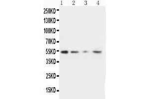 Lane 4: HELA Cell Lysate (MMP10 抗体  (C-Term))