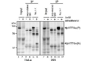Western Blotting (WB) image for anti-Activating Transcription Factor 6 (ATF6) (N-Term) antibody (ABIN2451924) (ATF6 抗体  (N-Term))