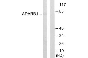 Western blot analysis of extracts from HepG2 cells, using ADARB1 antibody. (RED1 抗体  (Internal Region))