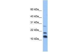 Western Blotting (WB) image for anti-C1D Nuclear Receptor Corepressor (C1D) (Middle Region) antibody (ABIN928381)