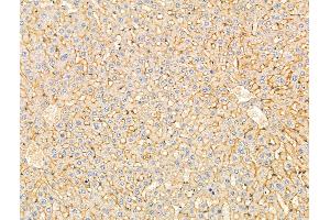 ABIN7094870 and ABIN7098922 at 1/100 staining Rat liver tissue by IHC-P. (Der1-Like Domain Family, Member 2 (DERL2) (C-Term) 抗体)