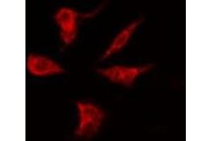 ABIN6275226 staining Hela by IF/ICC. (PGRMC2 抗体  (C-Term))