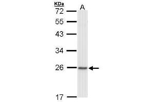 WB Image Sample (30 ug of whole cell lysate) A: Raji 12% SDS PAGE antibody diluted at 1:1000 (CBX1 抗体  (Center))