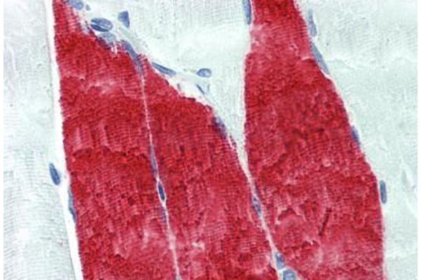 Troponin I 抗体