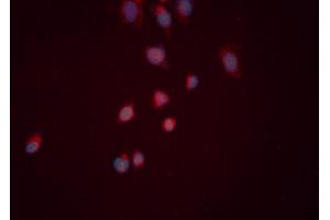 ABIN6276519 staining HeLa cells by ICC/IF. (CYR61 抗体  (Internal Region))