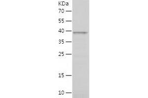 Western Blotting (WB) image for Chromosome 9 Open Reading Frame 72 (C9ORF72) (AA 1-198) protein (His-IF2DI Tag) (ABIN7284129) (C9ORF72 Protein (AA 1-198) (His-IF2DI Tag))