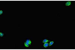 Immunofluorescence (IF) image for anti-UV Radiation Resistance Associated Gene (UVRAG) (AA 375-425) antibody (ABIN7175178)