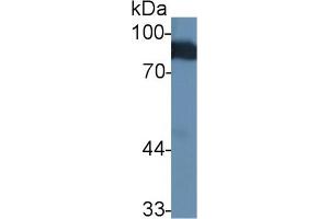 Detection of ANG in Human Serum using Polyclonal Antibody to Angiostatin (ANG) (Angiostatin 抗体  (AA 79-466))