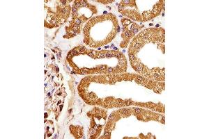 Immunohistochemistry (Paraffin-embedded Sections) (IHC (p)) image for anti-MORC Family CW-Type Zinc Finger 3 (MORC3) (AA 634-663) antibody (ABIN1881548)