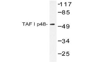 Western blot (WB) analyzes of TAF I p48 antibody in extracts from HeLa cells. (SET/TAF-I 抗体)