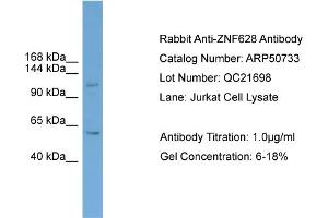 WB Suggested Anti-ZNF628  Antibody Titration: 0. (ZNF628 抗体  (Middle Region))
