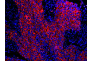 Immunofluorescence (IF) image for anti-Stratifin (SFN) (AA 198-248) antibody (ABIN7448925) (14-3-3 sigma/SFN 抗体  (AA 198-248))