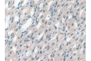 Immunohistochemistry (IHC) image for anti-Glutathione S-Transferase mu 4 (GSTM4) (AA 21-215) antibody (ABIN7444301)
