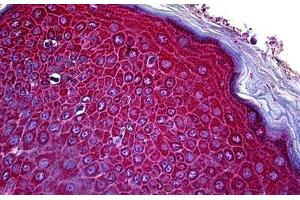 Human Skin: Formalin-Fixed, Paraffin-Embedded (FFPE) (CCR3 抗体  (N-Term))