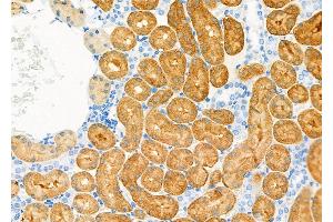 ABIN6265371 and ABIN6277613 at 1/100 staining Rat kidney tissue by IHC-P.