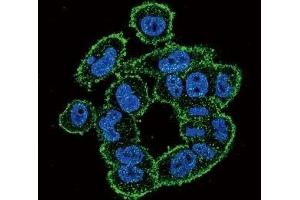 Confocal immunofluorescent analysis of UPA antibody with A2058 cells followed by Alexa Fluor 488-conjugated goat anti-rabbit lgG (green). (PLAU 抗体  (AA 396-426))