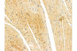 ABIN7094300 and ABIN7098347 at 1/100 staining Mouse heart tissue by IHC-P.