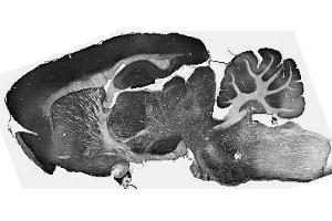 Adult rat brain immunohistochemistry.