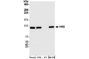 Western Blotting (WB) image for anti-HRS (HRS) (C-Term) antibody (ABIN7450342) (HRS (HRS) (C-Term) 抗体)