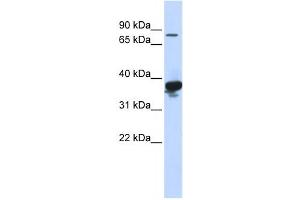 Western Blotting (WB) image for anti-LON Peptidase N-terminal Domain and Ring Finger 2 (LONRF2) antibody (ABIN2458756) (LONRF2 抗体)