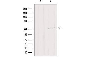 Western blot analysis of extracts from 293, using CALCOCO2 antibody. (CALCOCO2 抗体  (Internal Region))