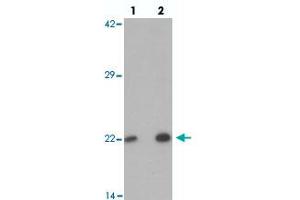 Western blot analysis of PHOX2B in 293 cell lysate with PHOX2B polyclonal antibody  at (lane 1) 1 and (lane 2) 2 ug/mL. (PHOX2B 抗体  (Internal Region))