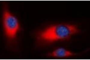 Immunofluorescent analysis of PAK1 staining in HeLa cells. (PAK1 抗体)
