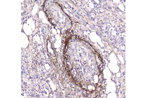 IHC analysis of Serum Amyloid P using anti-Serum Amyloid P antibody . (APCS 抗体  (AA 20-220))