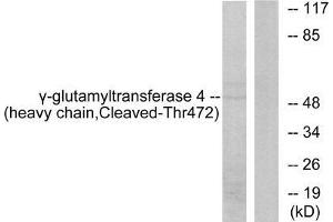 Western blot analysis of extracts from Jurkat cells, treated with etoposide (25uM, 24hours), using Gamma-glutamyltransferase 4 (heavy chain, Cleaved-Thr472) antibody. (GGT7 抗体  (Internal Region))
