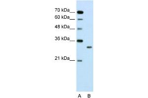 WB Suggested Anti-SBDS Antibody Titration:  2. (SBDS 抗体  (N-Term))