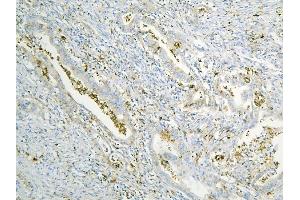 IHC analysis of ANXA3 using anti-ANXA3 antibody (ABIN6719269). (Annexin A3 抗体  (AA 23-323))