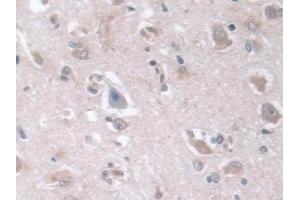 Immunohistochemistry (IHC) image for anti-D-2-Hydroxyglutarate Dehydrogenase (D2HGDH) (AA 56-232) antibody (ABIN7442156)