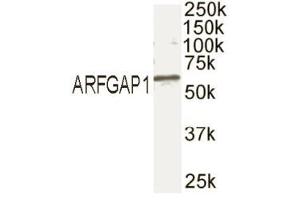 Western blot analysis of ARFGAP1 in mouse brain extract with ABIN121678. (RHOU 抗体  (C-Term))