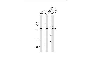 All lanes : Anti-Dsiglec-W20 at 1:2000 dilution Lane 1: A549 whole cell lysate Lane 2: NCI- whole cell lysate Lane 3: Human liver lysate Lysates/proteins at 20 μg per lane. (SIGLEC7 抗体  (N-Term))