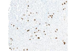 Immunohistochemistry (IHC) image for anti-Chemokine (C-X3-C Motif) Receptor 1 (CX3CR1) (AA 300-350) antibody (ABIN7795802) (Recombinant CX3CR1 抗体  (AA 300-350))