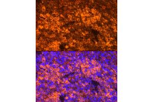 Immunofluorescence analysis of Mouse spleen using CCL5/RANTES antibody (ABIN6129369, ABIN6138063, ABIN6138065 and ABIN6218473) at dilution of 1:100.