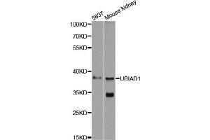 Western blot analysis of extracts of various cell lines, using UBIAD1 antibody (ABIN6293616) at 1:500 dilution. (UBIAD1 抗体)
