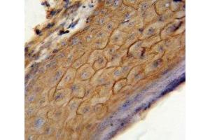 Immunohistochemistry (IHC) image for anti-Cannabinoid Receptor 2 (CNR2) (AA 329-356) antibody (ABIN3030275)