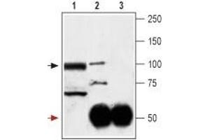 Immunoprecipitation (IP) image for anti-Glutamate Receptor, Ionotropic, AMPA 3 (GRIA3) (AA 60-73), (Extracellular) antibody (ABIN7043222)