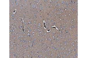 IHC analysis of EHD3 using anti-EHD3 antibody (ABIN7602777). (EHD3 抗体  (C-Term))