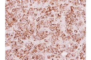 IHC-P Image Immunohistochemical analysis of paraffin-embedded MCF7 xenograft, using TST, antibody at 1:250 dilution. (TST 抗体)